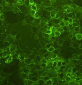 IF of A-431 GFP cells labeled with DSHB antibody DSHB-GFP-2G6 against green fluorescent protein (GFP). Image credit: Soll Laboratory, University of Iowa. 
